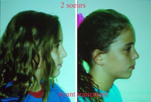 D but de ttt - Eugenol