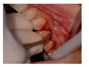Diapositive2 eoj4ug - Eugenol