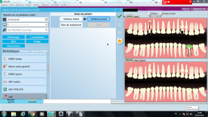Double fenêtre ho7obd - Eugenol