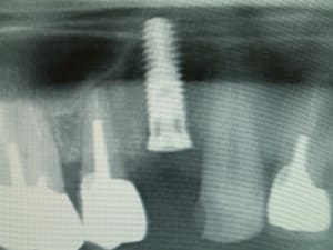 Dscf0029 ptudjj - Eugenol