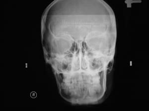 Dscf0399 ddrr2q - Eugenol
