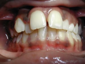Dscn1840 fuiazd - Eugenol