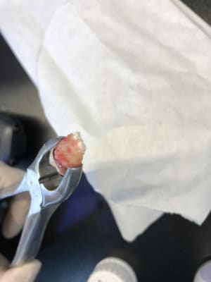 E486ddbb 4ca6 4360 a66f 168b60fa647d wctmst - Eugenol