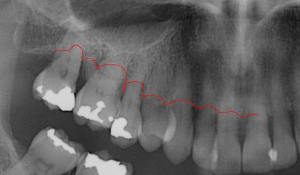 Fa elis05.04 - Eugenol