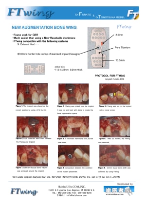 Ftwing koefra - Eugenol