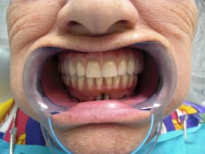 Fin1 pmoxk0 - Eugenol