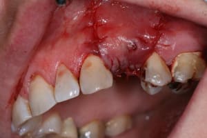 Fin vue lat rale azep12 - Eugenol