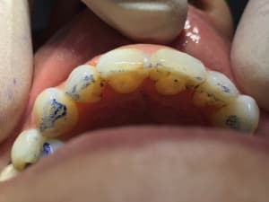 Fullsizerender 1  xkgg3s - Eugenol