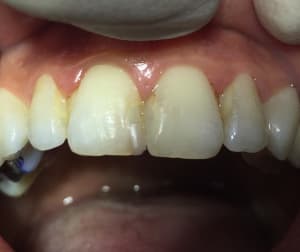 Fullsizerender hki1qh - Eugenol