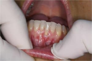 Gec1 ssj9kp - Eugenol