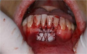 Gec5 dce54v - Eugenol