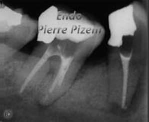 Go 44pendant copie zynnnl - Eugenol