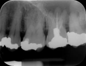 Huge itfxmx - Eugenol