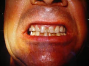 Imgp0193 es7esi - Eugenol