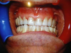 Imgp0194 qd9obv - Eugenol