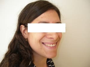 Imgp8144 yw7ope - Eugenol