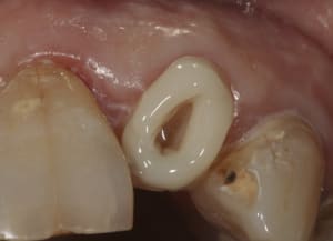 Img 0008 lvy5wo - Eugenol