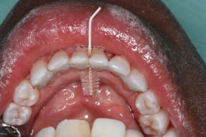 Img 002 e11zdg - Eugenol