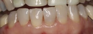 Img 0116   version 2 mas0uf - Eugenol