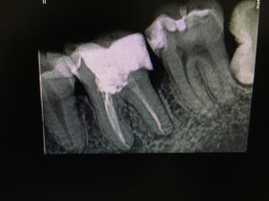 Img 0148 nvqa6d - Eugenol