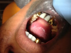 Img 0176 pwyr4q - Eugenol