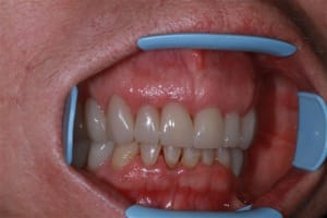 Img 0190 abjufu - Eugenol