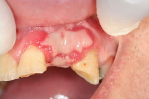 Img 0194 fzeyrv - Eugenol