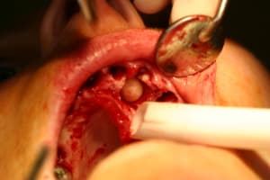Img 0207 cf978v - Eugenol