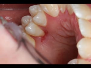 Img 0235 640x480 lg2lft - Eugenol