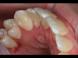 Img 0237 640x480 dhiqke - Eugenol