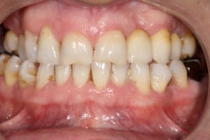 Img 0273 ixuoy0 - Eugenol