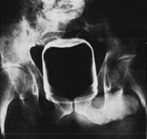 Img 0285 wy9ewy - Eugenol