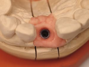 Img 0304 hjto1d - Eugenol