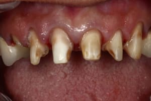 Img 0306 dlekdx - Eugenol