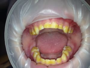 Img 0452 ik1miv - Eugenol