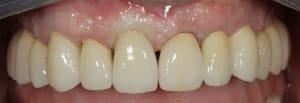 Img 0465 vtsiqp - Eugenol