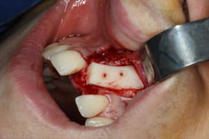 Img 0538 cemxzm - Eugenol