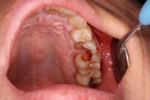 Img 0639 wwprio - Eugenol