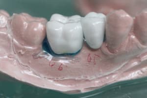 Img 0684 fstlmm - Eugenol