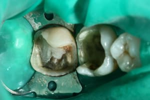 Img 0685 ifiupf - Eugenol