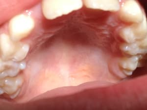 Img 0693 niusds - Eugenol