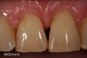 Img 0812 afge9k - Eugenol