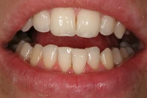 Img 0819 xr9ik0 - Eugenol