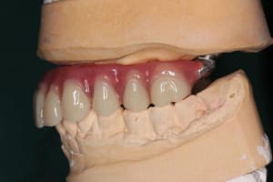 Img 0978 oqjhoh - Eugenol