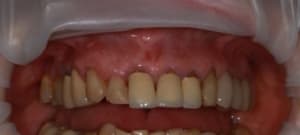 Img 0997 nsgyyl - Eugenol