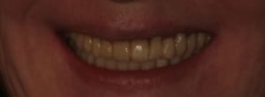 Img 1027c jw5nzx - Eugenol