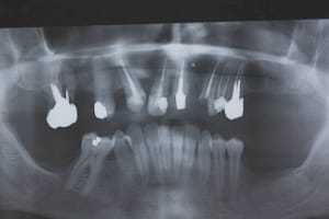 Img 1238proper x9tesd - Eugenol