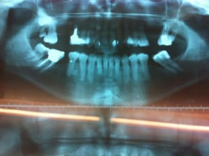 Img 1241 i3c25n - Eugenol