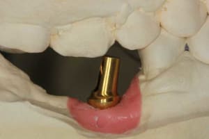 Img 1521 xs4mln - Eugenol