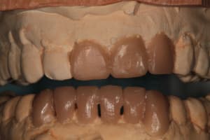 Img 1589 b6dje6 - Eugenol
